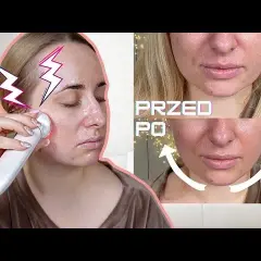 Jakie kosmetyki do mezoterapii bezigłowej naprawdę działają?