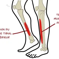Schéma des muscles du tibia, montrant la tension du muscle tibial antérieur et postérieur, cause fréquente de mal au tibia.
