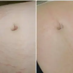 Gdzie kupić deep phyto peeling i uniknąć nieefektywnych produktów