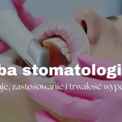 Plombowanie zęba: Ile to potrwa? Czas, etapy i komfort wizyty