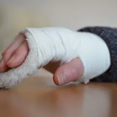 Złamany nadgarstek: Ile trwa rehabilitacja? Klucz do sukcesu