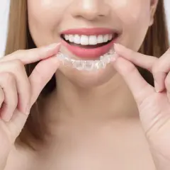 Sonrisa radiante con férula transparente de cera ortodoncia invisalign.