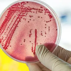 Symptome E. coli: Erkennen Sie die gefährlichen Anzeichen einer Infektion