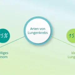 Grafik zeigt Lungenkrebsarten: 85% nicht-kleinzelliges Lungenkarzinom, 15% kleinzelliges Lungenkarzinom.