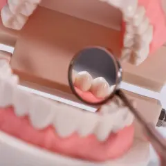 Model szczęki z lusterkiem dentystycznym. Gdy boli zapalenie miazgi zęba, jak uśmierzyć ból?
