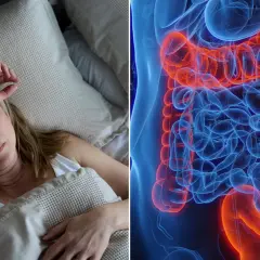 Frau im Bett, besorgt. Daneben eine 3D-Darstellung des Dickdarms mit einem Tumor, der zeigt, wohin Darmkrebs streut.
