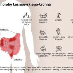 Ilustracja przedstawia objawy choroby Leśniowskiego-Crohna: zmęczenie, gorączkę, biegunkę, bóle brzucha, problemy z oczami i skórą.