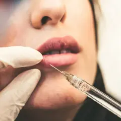 Zabieg powiększania ust strzykawką z igłą, wykonywany przez lekarza w rękawiczce.