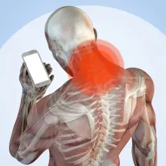 Anatomia del collo con aree rosse di dolore, che illustra il problema del "tech neck" causato dall'uso dello smartphone.