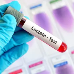 Ręka w niebieskiej rękawiczce trzyma probówkę z krwią do testu na mleczan. Wysoki poziom mleczanu może wskazywać na kwasicę.