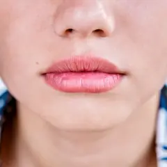 Gros plan sur une bouche aux lèvres légèrement gercées, d'une teinte rosée naturelle.