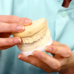 Model szczęki z widocznym pęknięciem, sugerującym, że wypadł implant zęba po kilku latach.