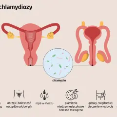 Objawy chlamydiozy u mężczyzn: ból przy oddawaniu moczu, obrzęk narządów płciowych, ropna wydzielina. Grafika pokazuje układ rozrodczy męski i żeński.