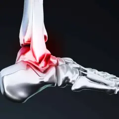 Illustration 3D d'une cheville, montrant la zone rouge de douleur et d'inflammation, essentielle pour la proprioception cheville.