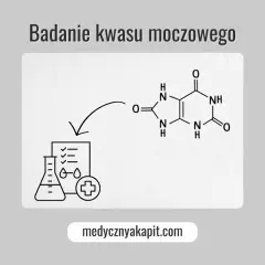 Badanie kwasu moczowego: schemat przedstawia jego wzór chemiczny i ikonografię symbolizującą analizę laboratoryjną.