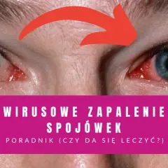 Czerwone, podrażnione oczy z widocznymi naczynkami. Napis: "Wirusowe zapalenie spojówek - poradnik".