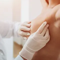 Lekarz w białej rękawiczce bada pierś. Po chemioterapii guz zniknął, przynosząc ulgę.