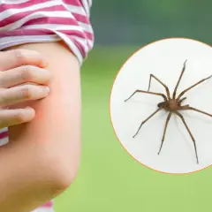 Brazo con erupción roja y picazón, junto a una araña marrón. Aprende cómo curar picadura de araña.
