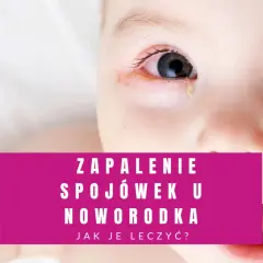 Co na zapalenie spojówek u niemowlaka - objawy, leczenie i profilaktyka