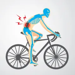 Skelett auf einem Fahrrad mit Schmerzsymbolen im unteren Rückenbereich, das auf Probleme mit der Fahrradergonomie hinweist.