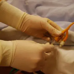 Ręce w rękawiczkach przygotowują cewnik do oddawania moczu po cewnikowaniu.