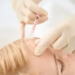 Botoks na usta: Ile trwa efekt? Poznaj czynniki trwałości!