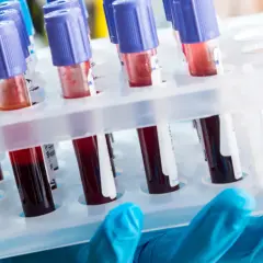 Diagnosta laboratoryjny i inni: Kto odpowiada za Twoje wyniki?
