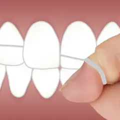 Dente pulito grazie al filo interdentale. Impara come usare il filo interdentale per una perfetta igiene orale.