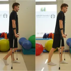 Jakie ćwiczenia po złamaniu kłykcia pomogą w szybszej rehabilitacji?