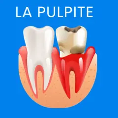 Dente sano e dente cariato con gengive infiammate. Illustrazione sulla pulpite, suggerendo la necessità di rimedi per il nervo dente infiammato.