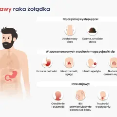 Ilustracja przedstawia objawy raka żołądka: utratę masy ciała, czarne stolce, uczucie pełności, niestrawność, zgagę, utratę apetytu, nudności, wymioty, osłabienie, duszność, ból pleców i trudności w połykaniu.