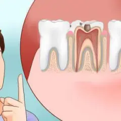 Ból zęba? Jak szybko poczuć ulgę i kiedy pilnie do dentysty.