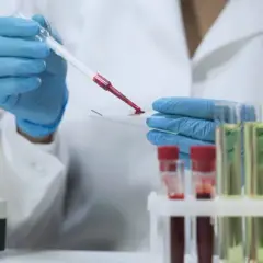 Jakie badanie na robaki u dziecka? Poznaj skuteczne metody diagnozy