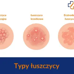 Ilustracja pokazuje trzy typy łuszczycy: zwyczajną, krostkową i erytrodermię łuszczycową. Ważne, by rozpoznać łuszczycę u dzieci.