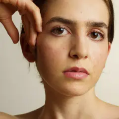 Visage d'une jeune femme aux yeux marron, présentant des rougeurs et des imperfections cutanées, évoquant l'acné et la ménopause.
