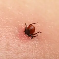 Objawy kleszczowego zapalenia opon mózgowych - nie przegap ich!