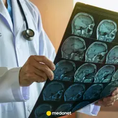 Lekarz analizuje serię rezonansów głowy, szukając oznak nieprawidłowego rezonansu.