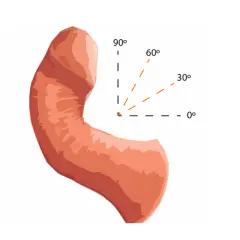 Ilustracja przedstawia wygląd penisa z zaznaczonymi kątami: 0°, 30°, 60° i 90°.