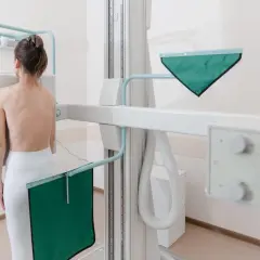 Kobieta stoi przed aparatem RTG, przygotowując się do badania. To właśnie RTG pozwala zajrzeć do wnętrza ciała.