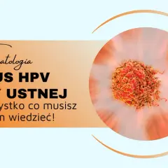 Wirus HPV w jamach ustnych może prowadzić do powstania brodawczaka. Dowiedz się więcej o tym zagrożeniu dla zdrowia jamy ustnej.