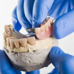 Dentyści prezentują protezę szkieletową na modelu. Poznaj atrakcyjną proteza szkieletowa cena.