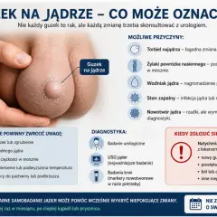 Guzek na jądrze może oznaczać różne rzeczy, w tym nowotwór jądra. Obraz pokazuje guzek na jądrze i wymienia objawy, przyczyny i diagnostykę.