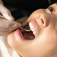 Uśmiechnięta pacjentka podczas zabiegu plastyka dziąseł. Dentysta bada zęby lusterkiem. Efekt plastyka dziąseł przed i po jest widoczny.