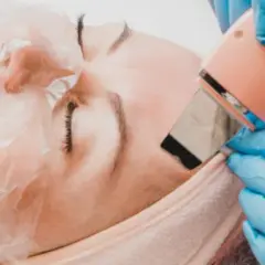 Co daje peeling kawitacyjny? Zobacz efekty i korzyści dla skóry