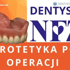 Gdzie zrobić protezę zębową na NFZ i uniknąć długiego czekania