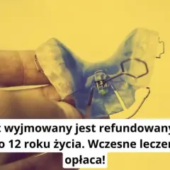 Ile naprawdę kosztuje aparat ruchomy? Sprawdź, czy Cię na to stać!
