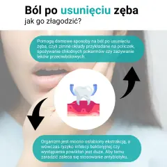 Jak długo boli po usunięciu zęba i jak szybko złagodzić nieprzyjemne dolegliwości