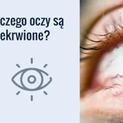 Dlaczego konie mają zasłonięte oczy? Powody, korzyści i zastosowanie klapek