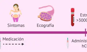 Proceso de donación de óvulos: síntomas, ecografía, medicación, estradiol alto y administración de hCG. A veces, duele donar óvulos.