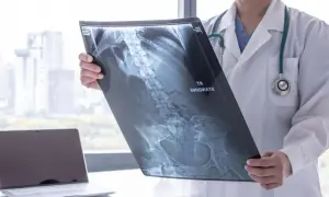 Lekarz analizuje RTG jamy brzusznej, widoczne kręgosłup i miednica.